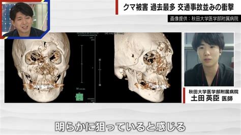 外傷紋 面相|顔面紋理の種々相